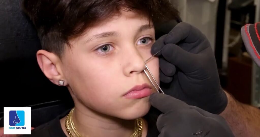 Can A 12-Year-Old Get A Nose Piercing