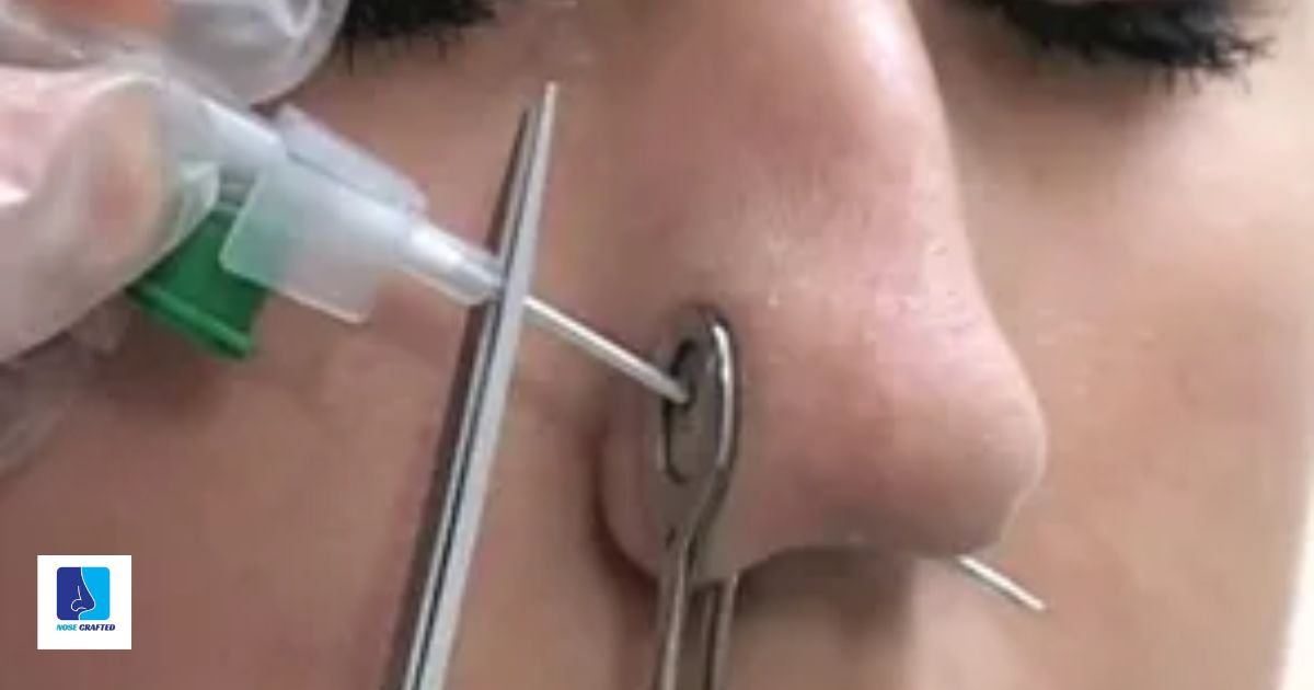 How To Stop Bleeding Nose Piercing