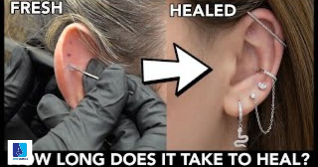 Signs That A Piercing Is Healed: