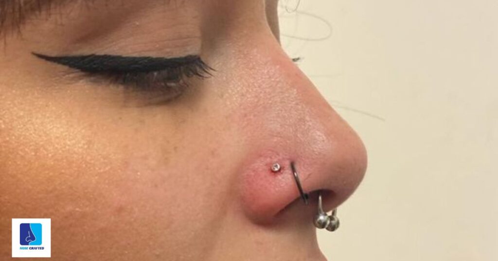 Studs, Hoops, and Beyond: Types of Nose Piercings