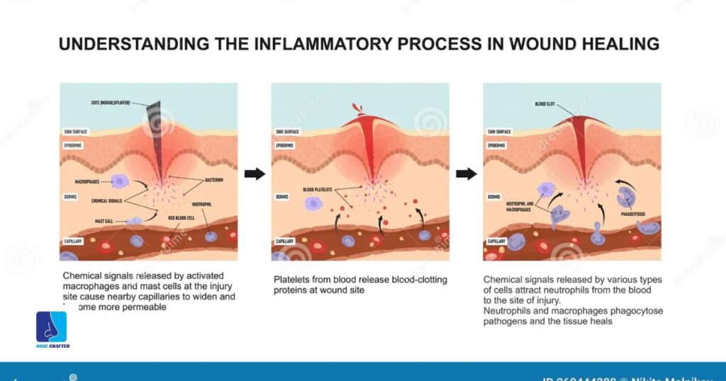 Understanding the Healing Process