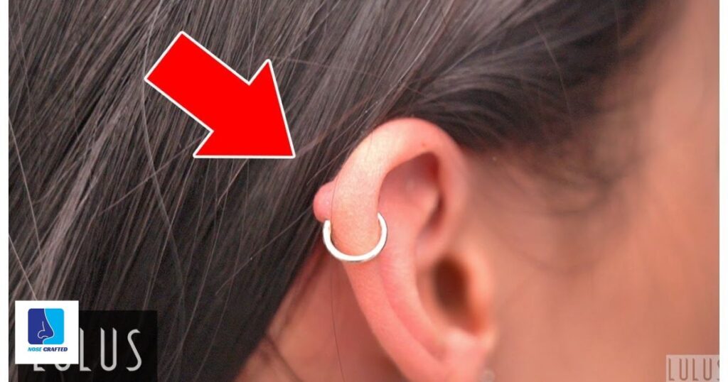 What Happens If You Change Your Ear Piercing Too Soon