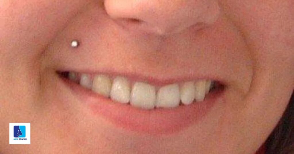 When to Remove the Original Piercing Stud