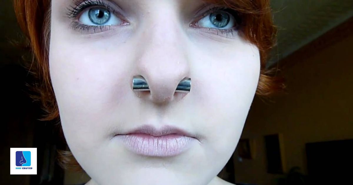 How To Get Rid Of Argyria From Nose Piercing?