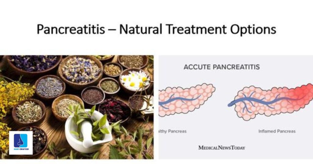 Treatment Options for Argyria