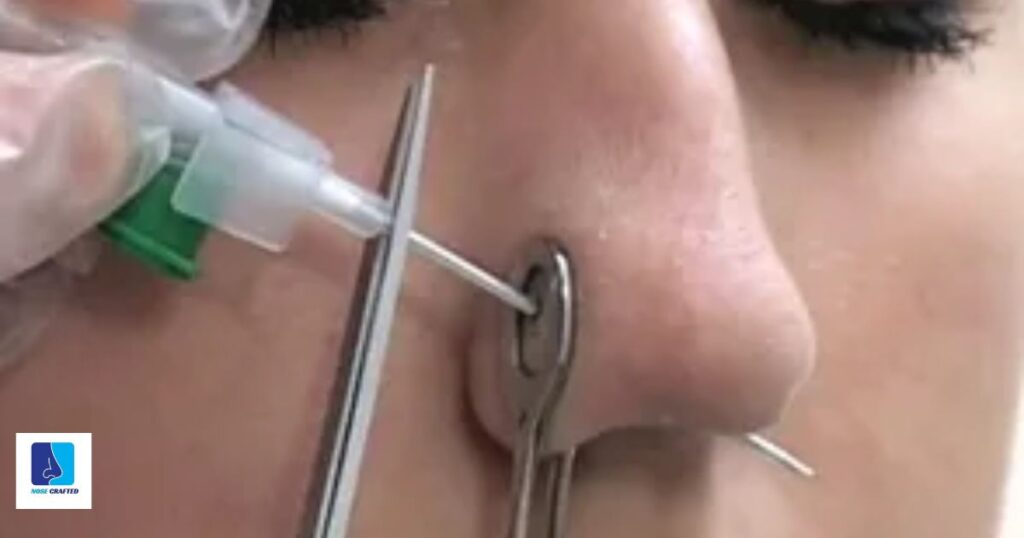Exploring Nose Piercing Gauge Measurements