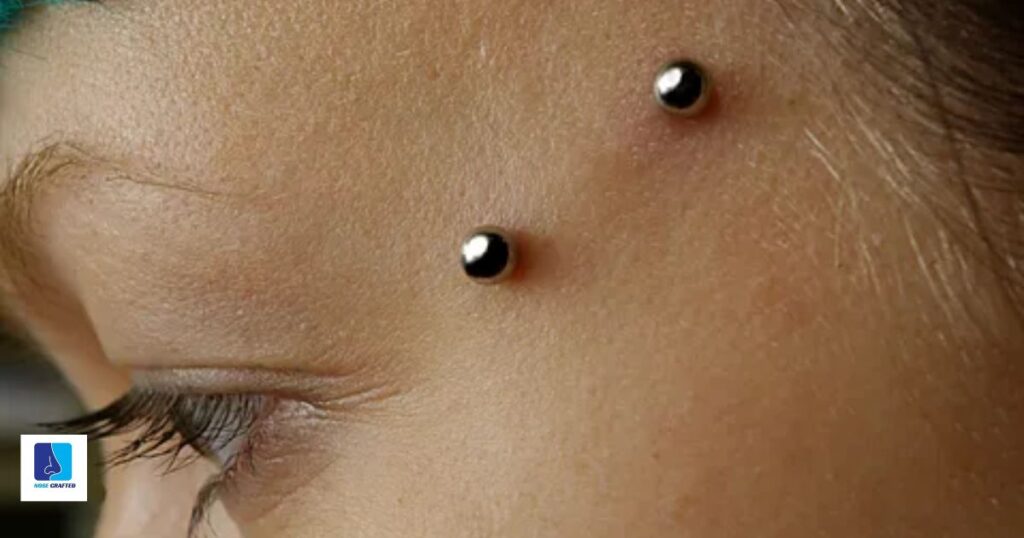 Can You Save A Piercing That’s Being Rejected?