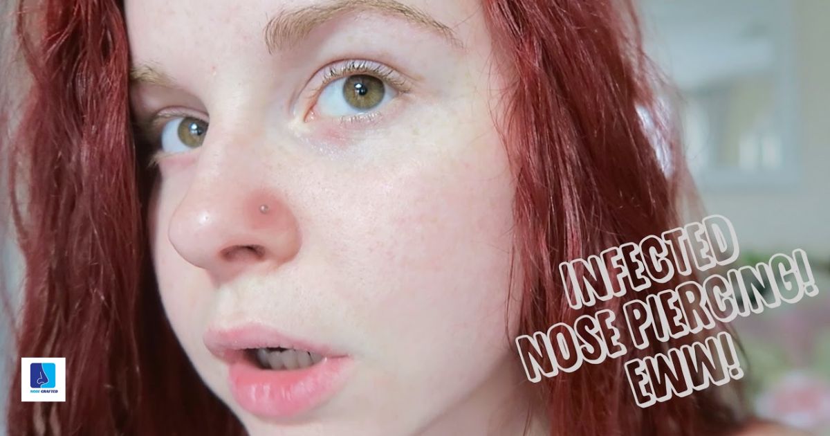 Is Your Nose Piercing Infected? A Comprehensive Guide To Recognize, Treat, And Prevent Infections
